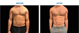 MYOslim NEO Body Fat Burning Carving Machine 15 Tesla EMS Electromagnetic Weight Loss Muscle Training Slimming Machine