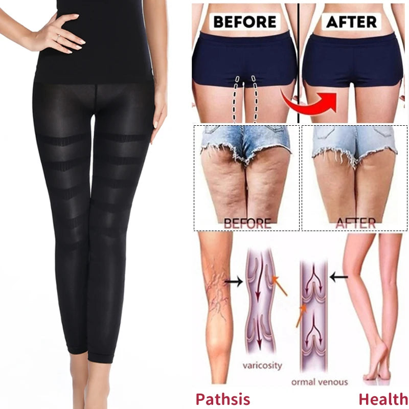 Anti-Cellulite Compression Leggings – High Waist Tummy Control & Thigh Slimming Body Shaper