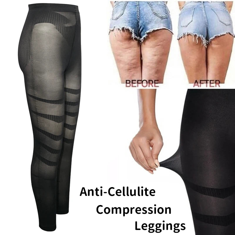 Anti-Cellulite Compression Leggings – High Waist Tummy Control & Thigh Slimming Body Shaper