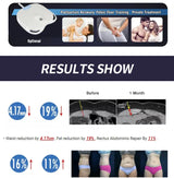 EMSzero HIEMT RF High Intensity Vibration Pulse Electronic Body Shaping Massage Muscle Massage
