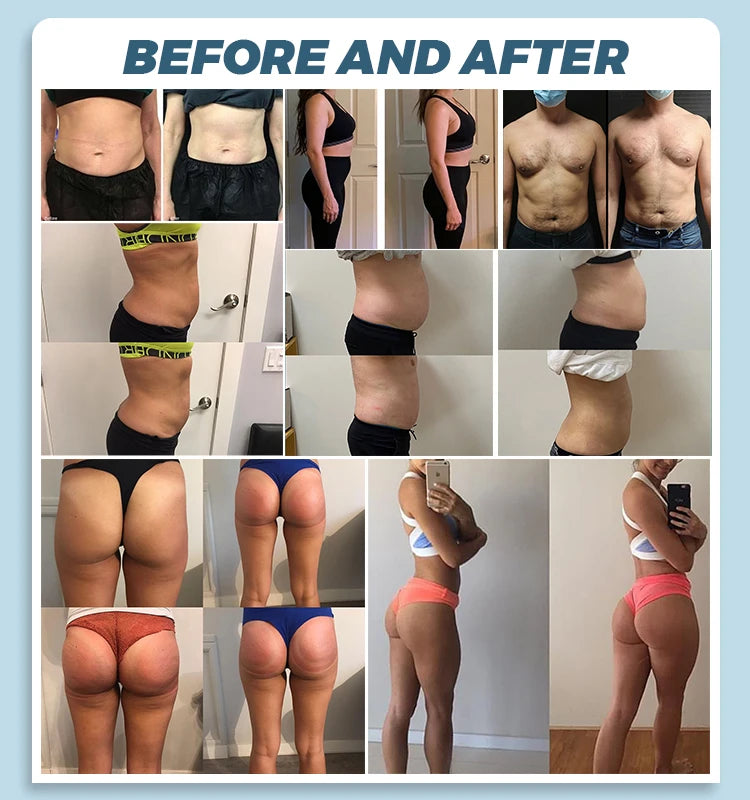 EMS Body Sculpting & RF Slimming Machine