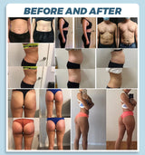 EMS Body Sculpting & RF Slimming Machine
