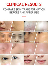 7 Colors PDT LED Mask 2025 Professional Facial Red Light Therapy Face Lift Anti Wrinkle Beauty Machine Skin Rejuvenation Device