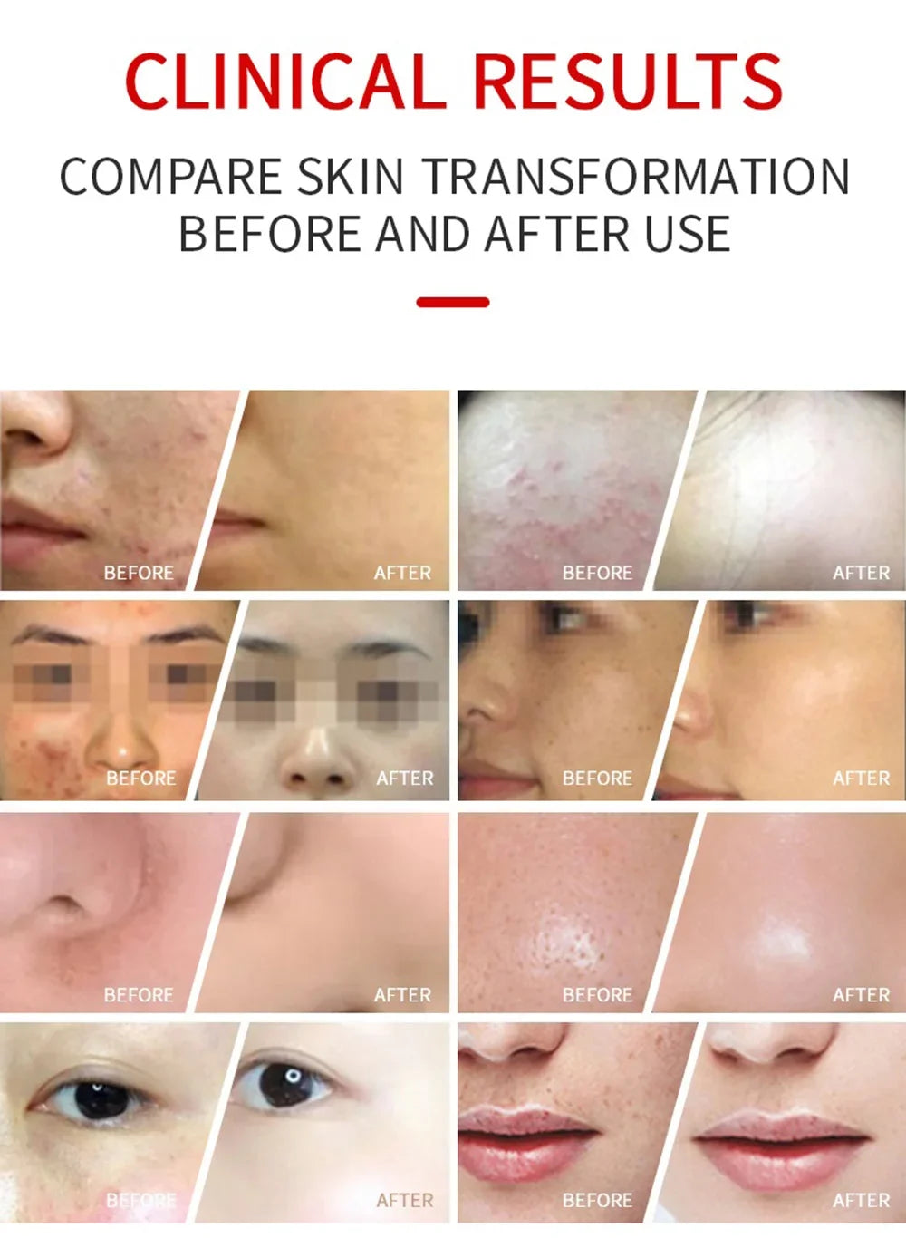 7 Colors PDT LED Mask 2025 Professional Facial Red Light Therapy Face Lift Anti Wrinkle Beauty Machine Skin Rejuvenation Device
