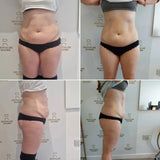 NEW 6500W EMS Neo RF Body Sculpt Machine PRO Ultra Mini Fat Burning EM Electromagnetic Muscle Stimulation Slim