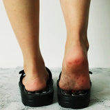 Acupoint Wellness Massage Slippers