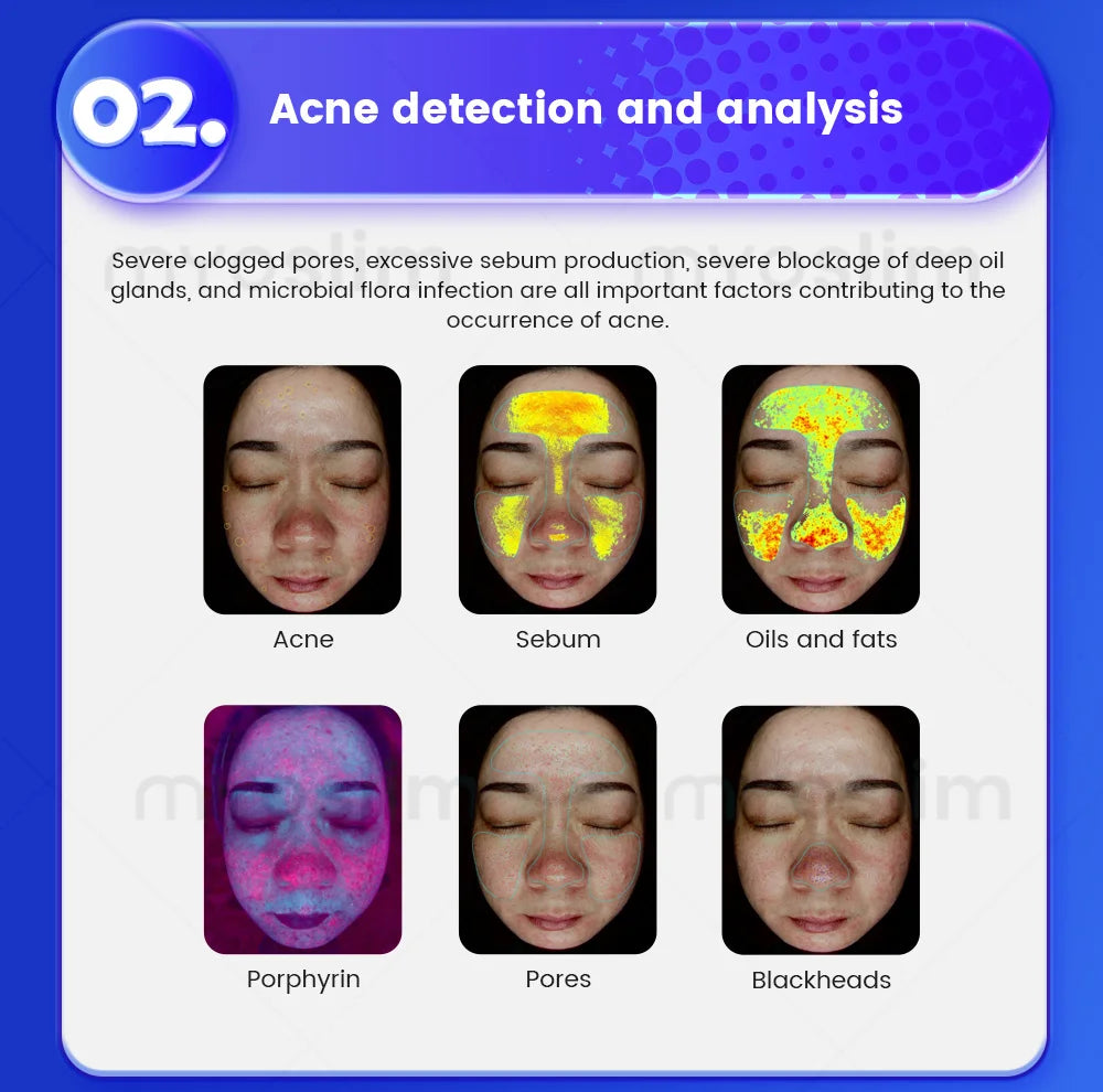 3D Magic Ai Facial Testing X5 ProMirror Wood Lamp Acne Scanner Skin Detector Skin Analyzer Facial Tester Facial Analyzer Machine