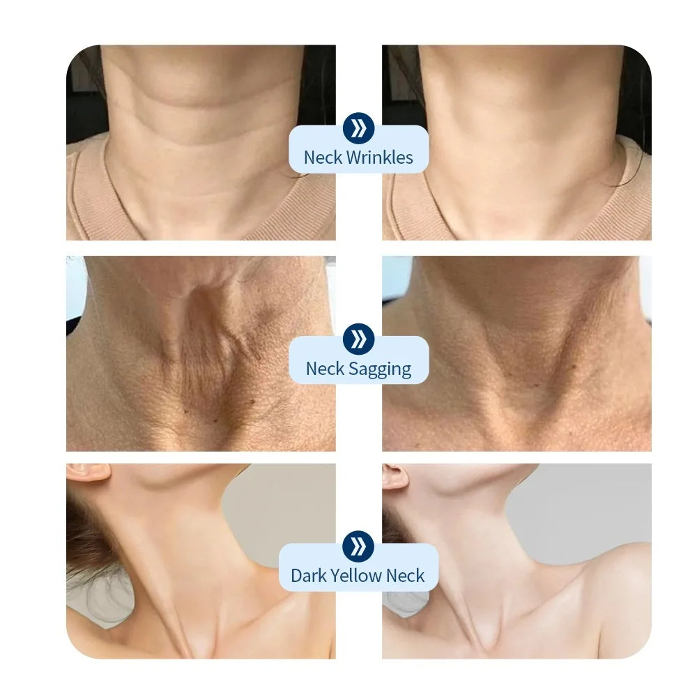 7-Color Photon LED Neck Rejuvenation Mask