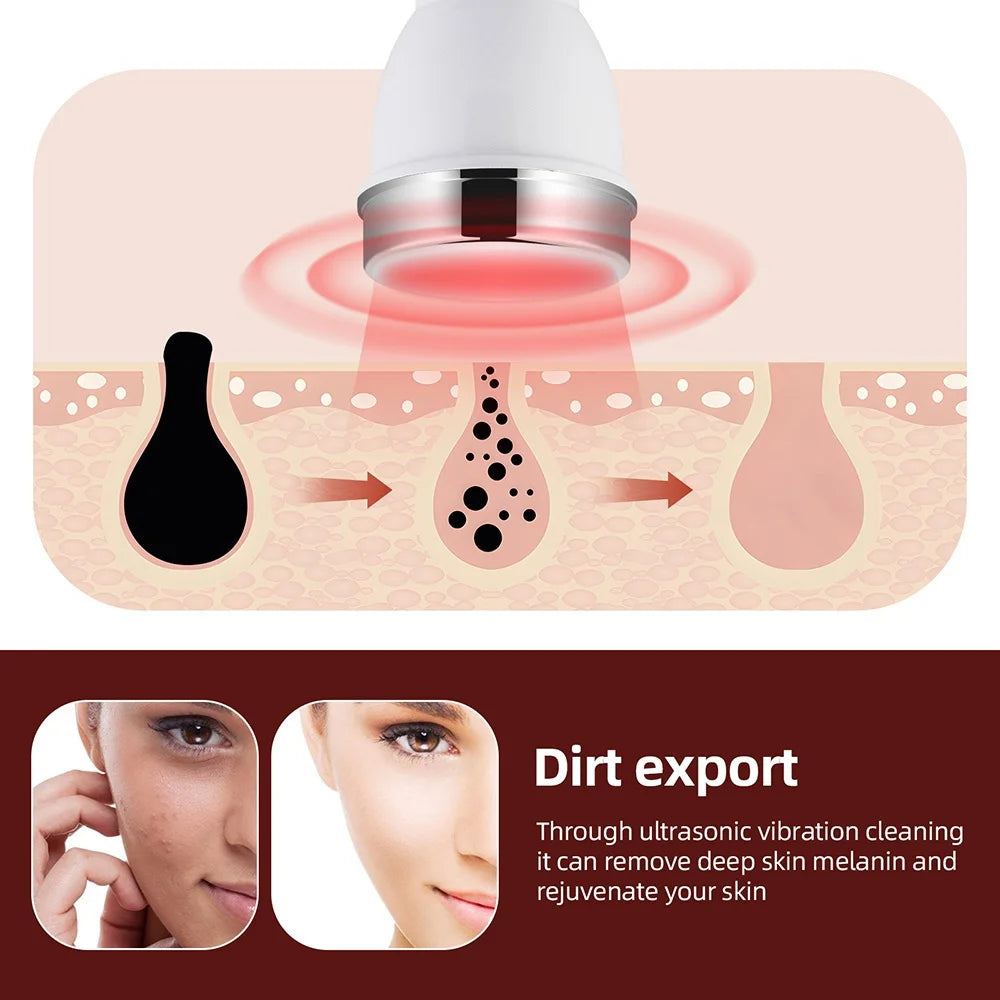 Ultrasonic Facial Beauty Device – Face & Eye Lift Massager