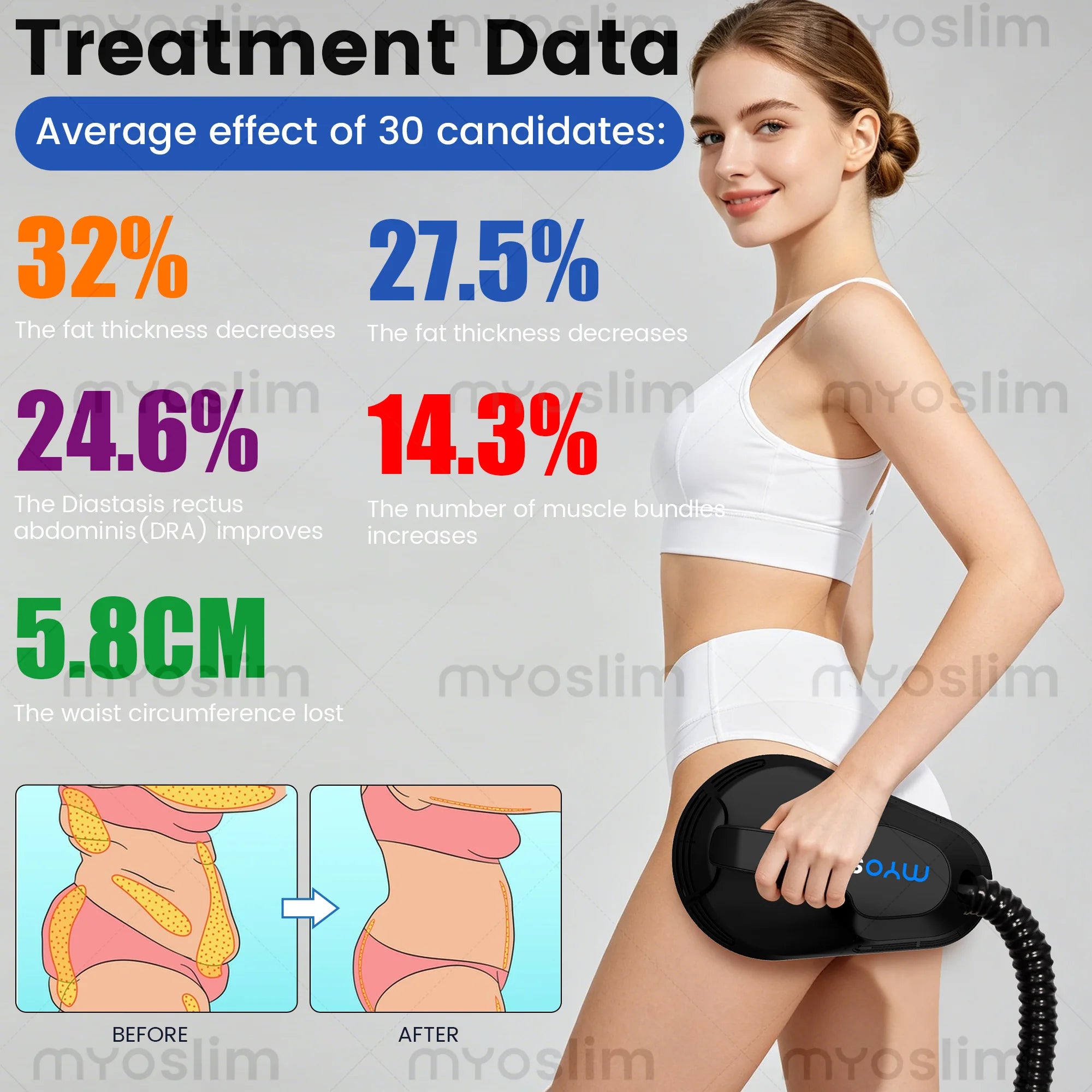MYoslim RF EMS Body Sculpt Machine Portable Pelvic Pad Muscle Stimulation Slimming Technology Sculpting Fat Electromagnetic