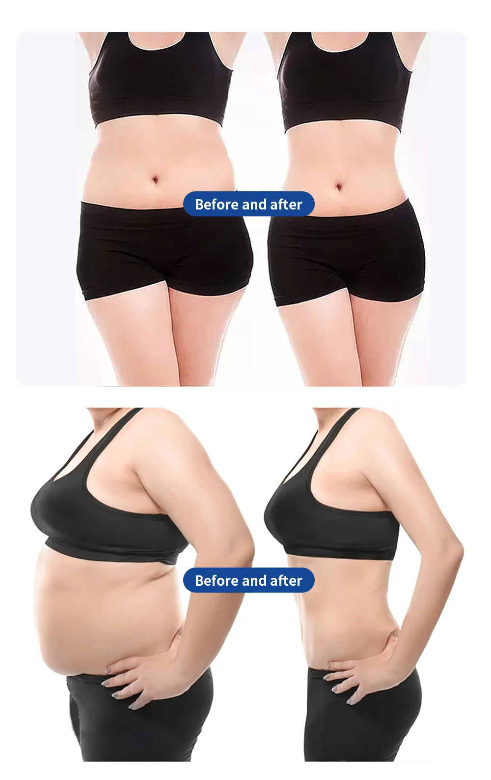 Myoslim Machine Professional EMS Body Muscle Stimulation Carving EMS Slimming Machine EMS Pro NEO RF Machine In Sculpt
