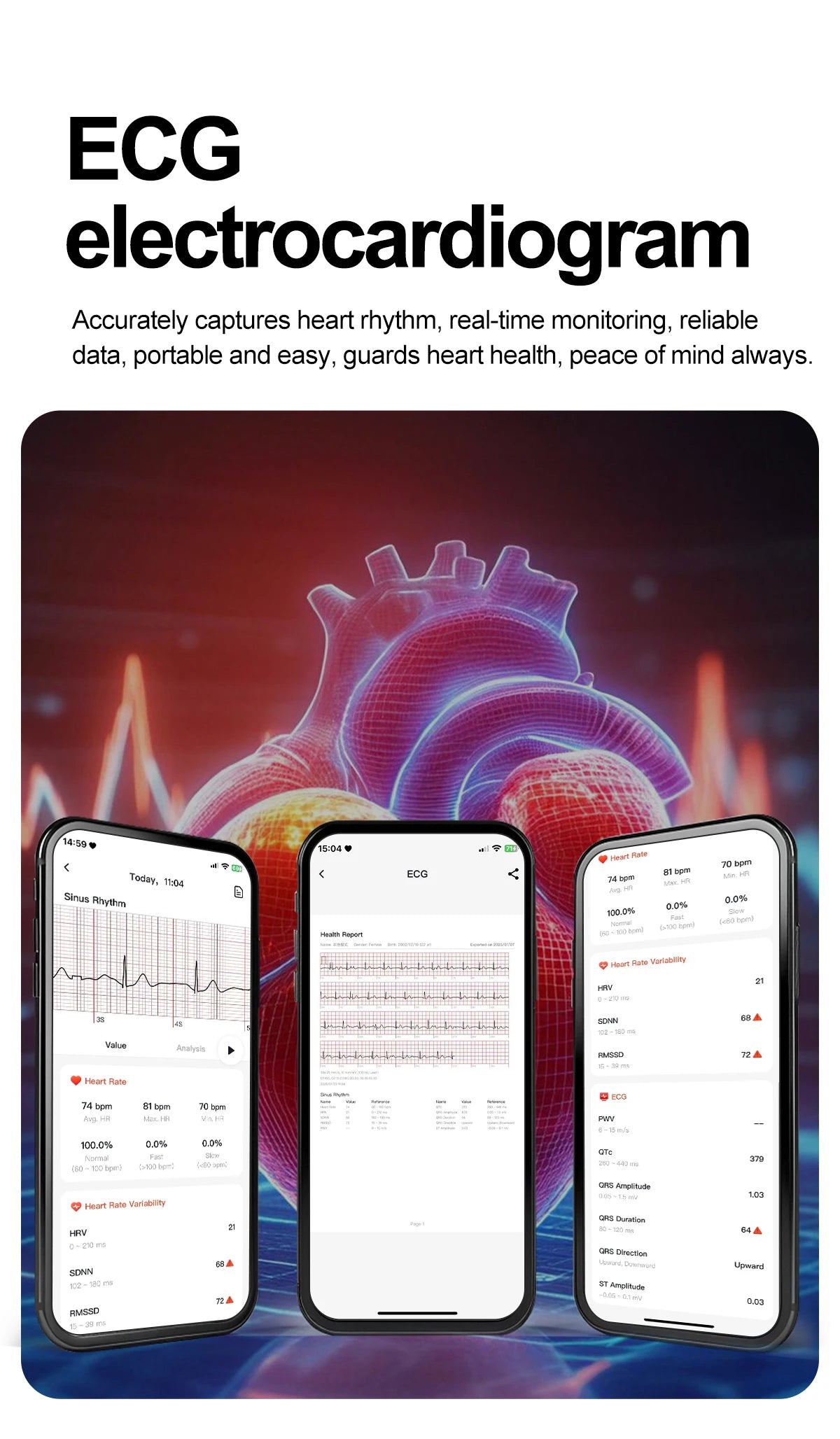 ECG+PPG Health Smartwatch – AI Body Analysis & BT Calling