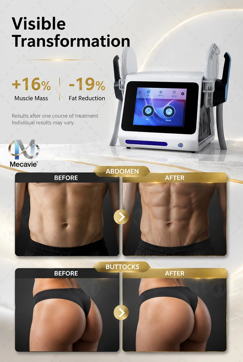 2026Latest EMS Body Building Machine with RF Fat Removal 2 Handles Muscle Sculpting for Fitness And Wellness Body Muscle Stimula