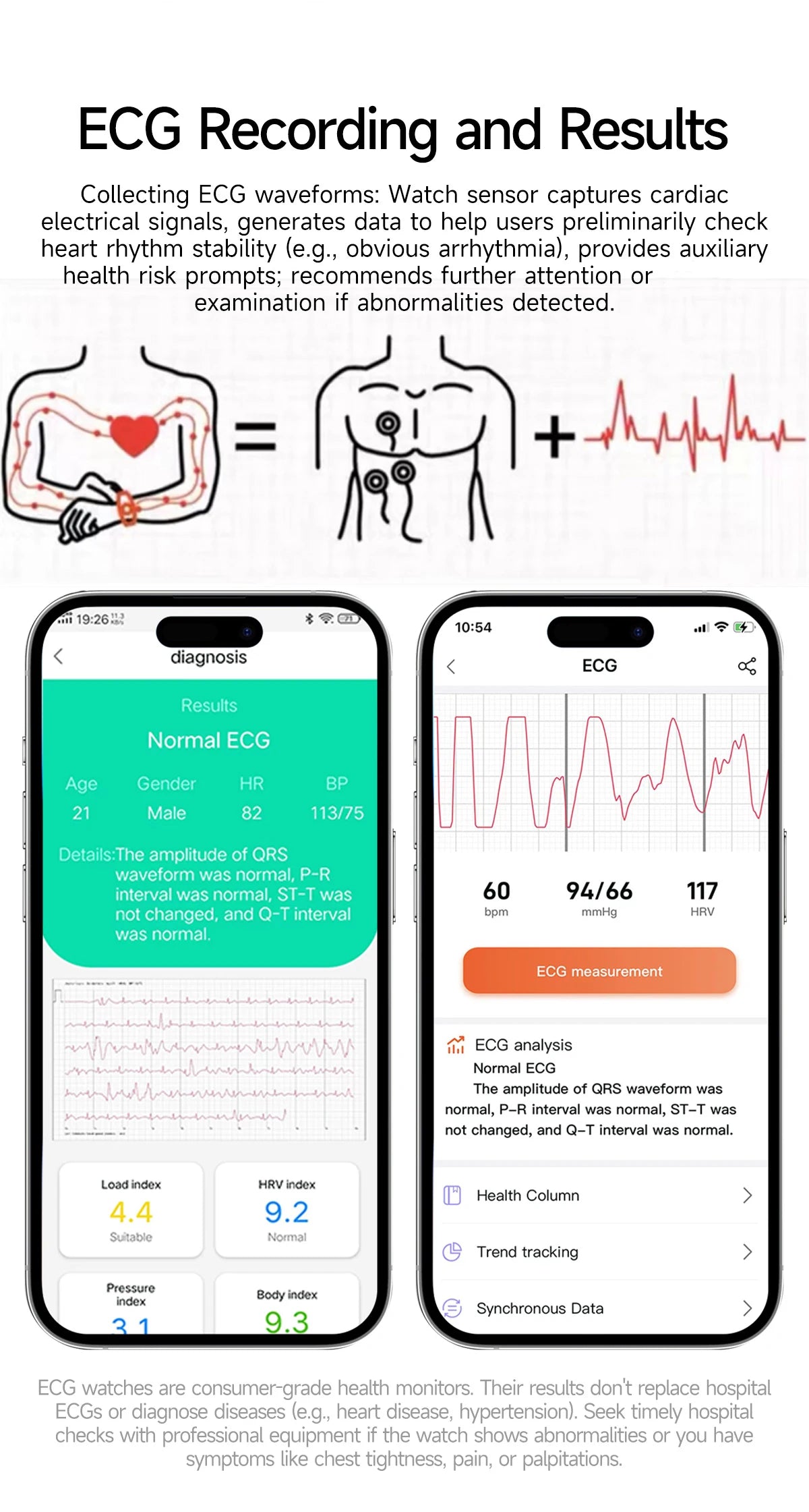 2026Hot AI-GPT Diagosis ECG Health SmartWatch Blood Pressure Lipid Uric Acid 650nm Dual-Probelaser Heart Analysis Smart bracelet
