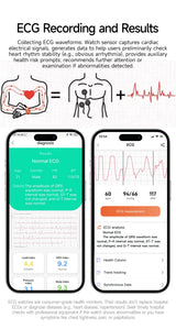 2026Hot AI-GPT Diagosis ECG Health SmartWatch Blood Pressure Lipid Uric Acid 650nm Dual-Probelaser Heart Analysis Smart bracelet