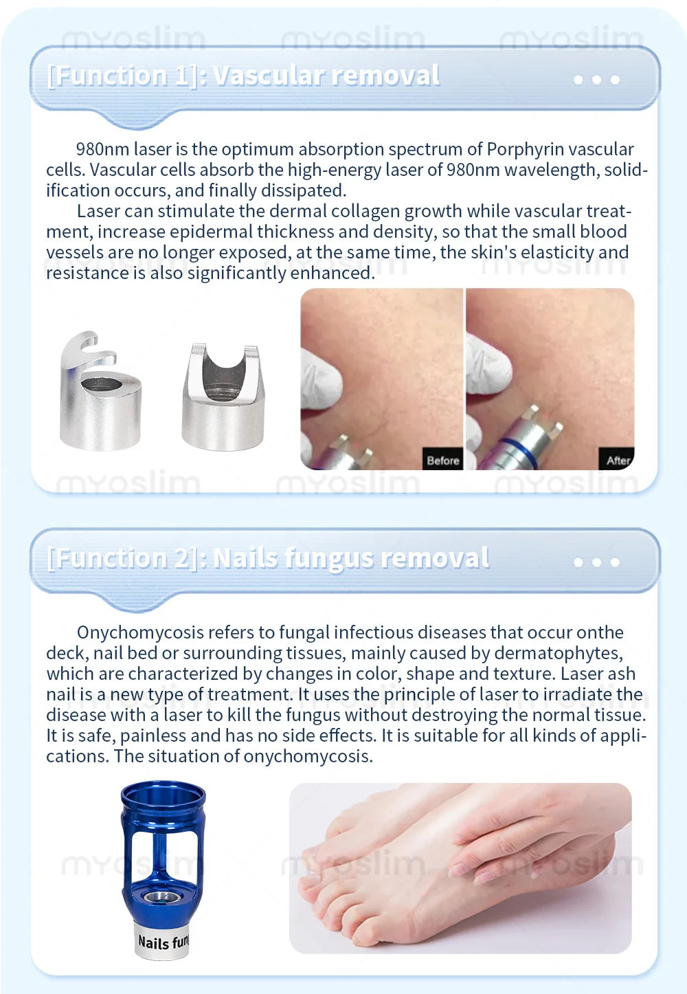 MYOSLIM 5-in-1 980nm Diode Laser Beauty Device
