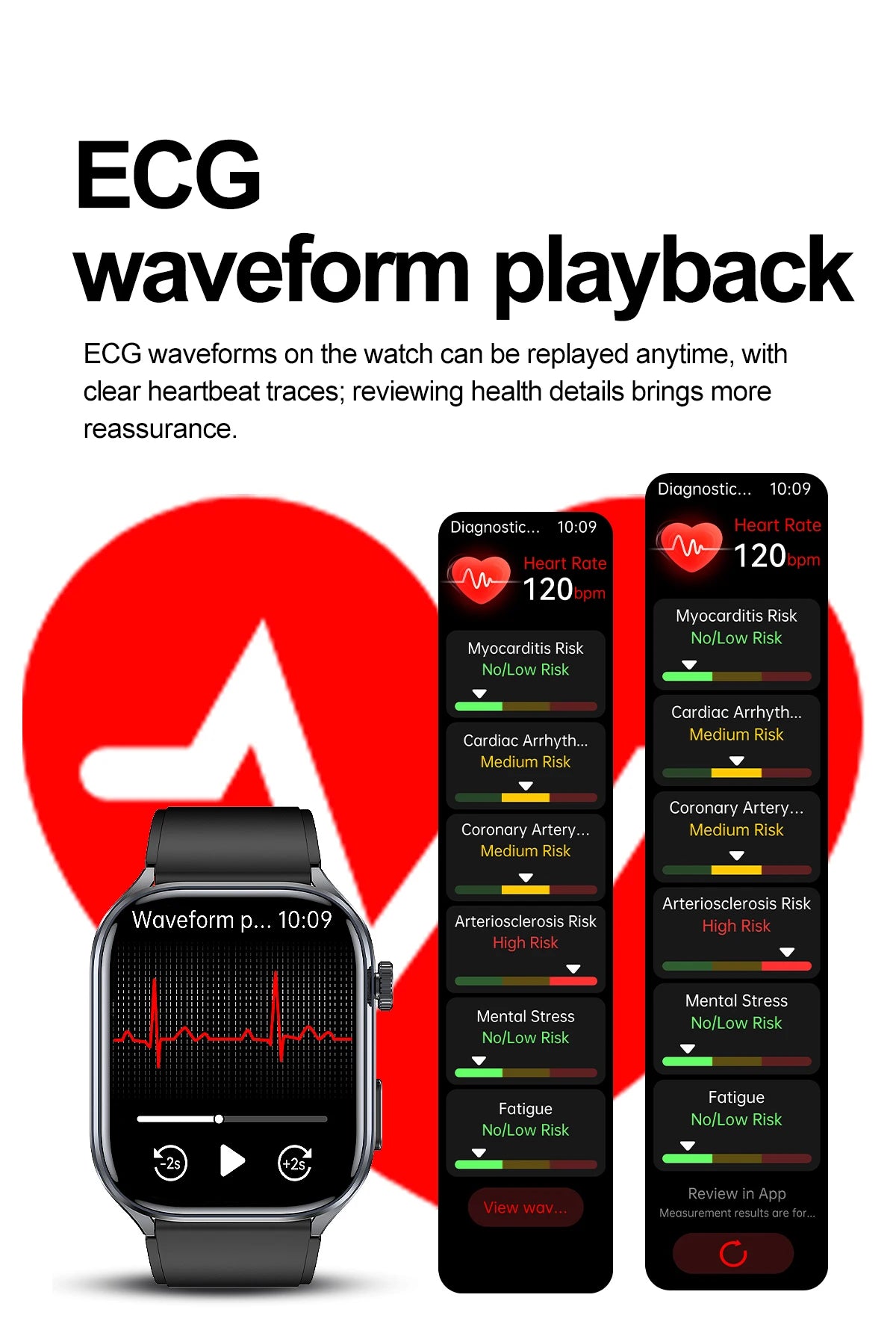 ECG+PPG Health Smartwatch – AI Body Analysis & BT Calling