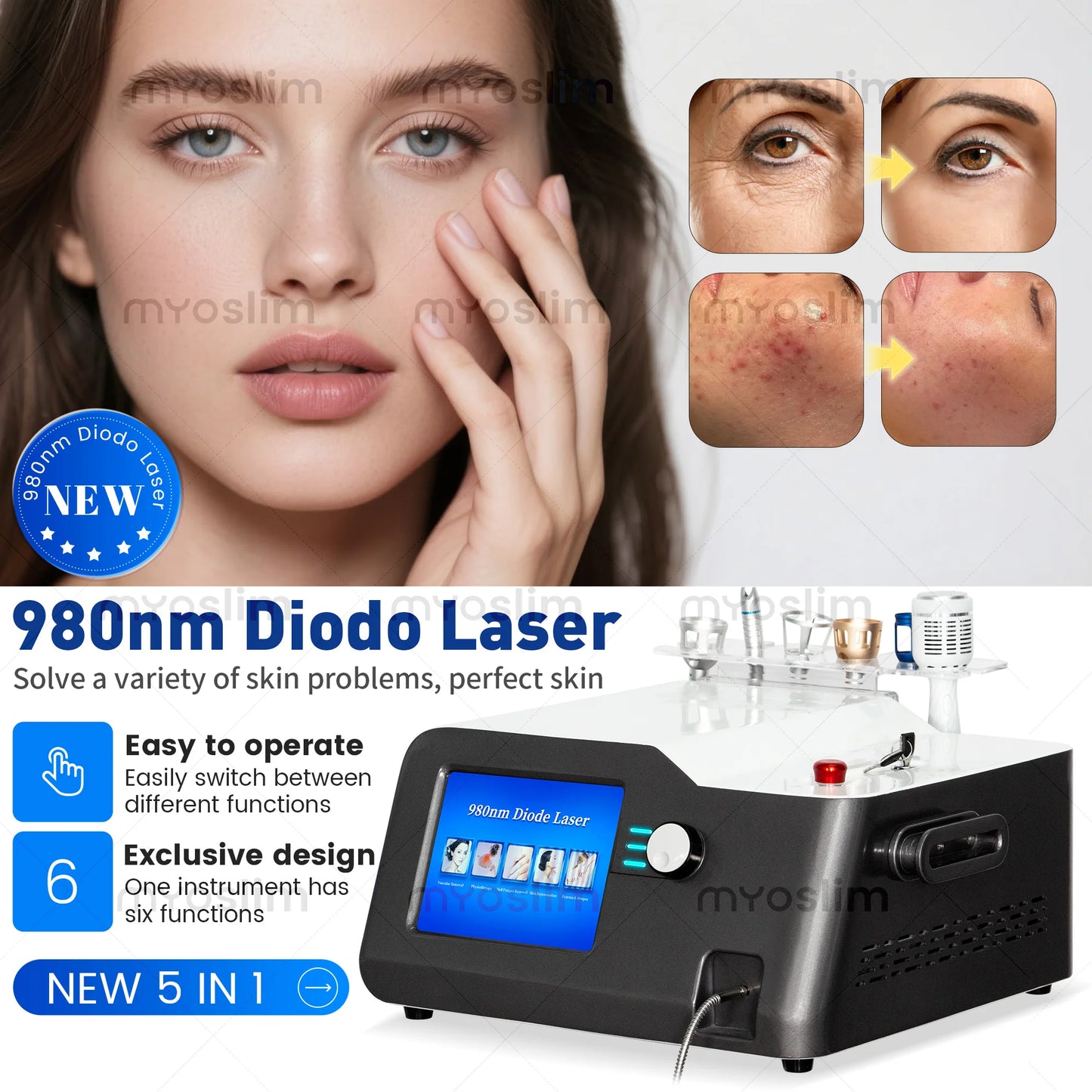 MYOSLIM 5-in-1 980nm Diode Laser Beauty Device