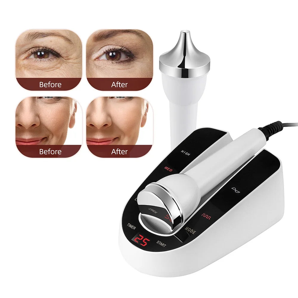 Ultrasonic Facial Beauty Device – Face & Eye Lift Massager